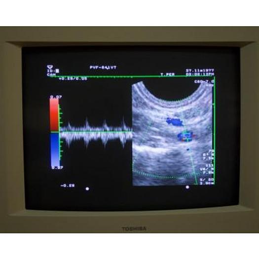 Usato ECHOGRAPHE COULEUR DOPPLER TOSHIBA ECOCEE SSA 340