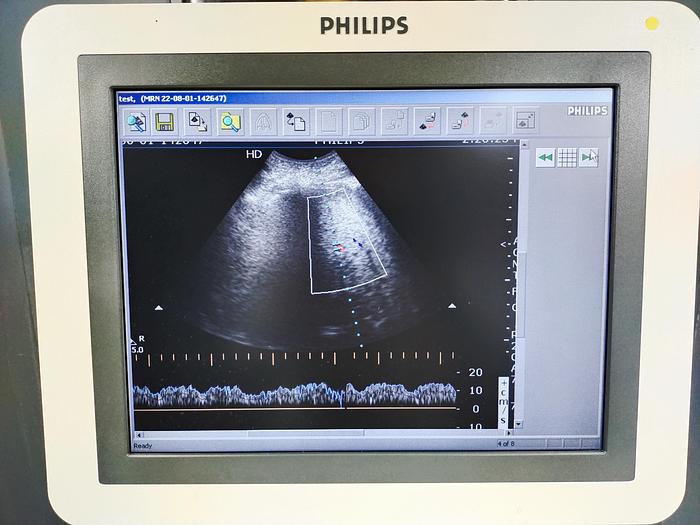 Gebraucht Philips HD7 diagnostik Ultraschallsystem mit DVD Brenner ohne Drucker SW 1.1
