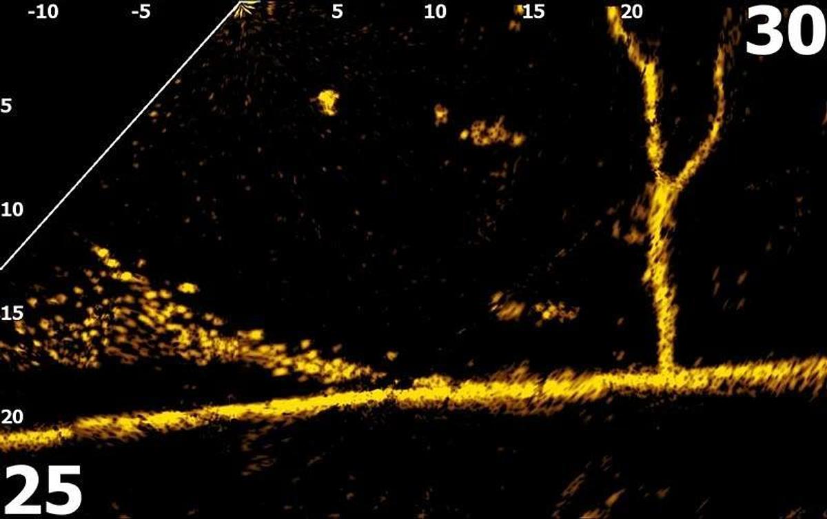 ActiveTarget 2 - Highest Resolution Live Sonar