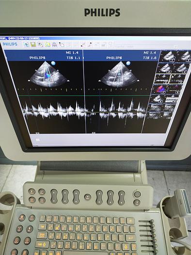 Gebraucht HD 11xe 2197 Ultraschallgerät mit 3 Sonden