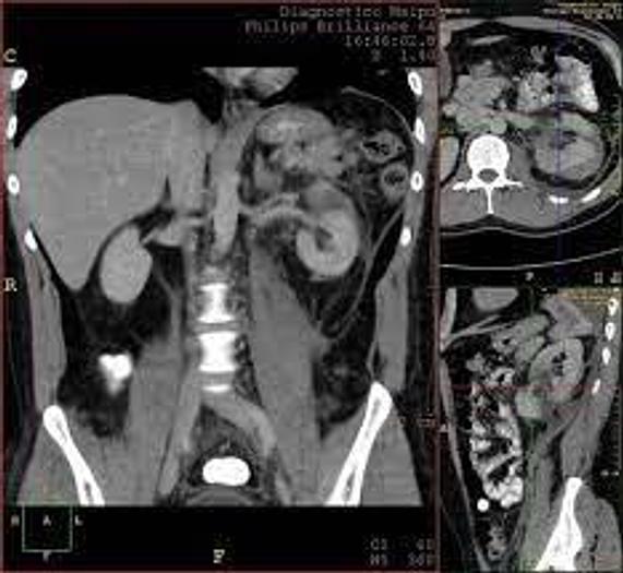 Refurbished 2007 General Electric (GE) BrightSpeed