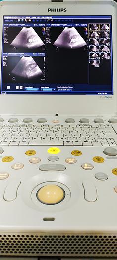 Gebraucht Philips CX50 tragbare Ultraschallgerät auf Philips CX Wagen inkl. Netzteil