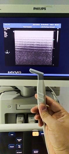 Gebraucht Philips L15-7io Sonde