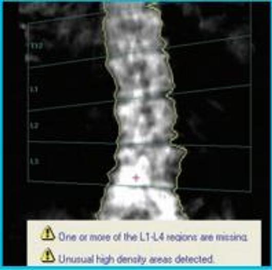 Used GE Lunar Densitometer 2012