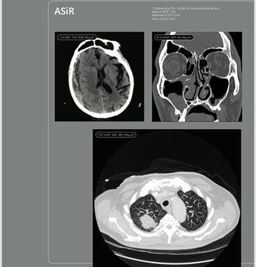 Refurbished 2007 General Electric (GE) BrightSpeed