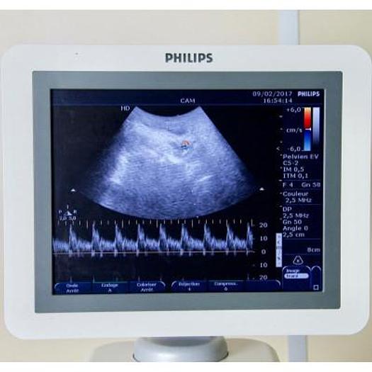 Used ECHOGRAPHE COULEUR DOPPLER PHILIPS HD 7 XE AVEC 3 SONDES
