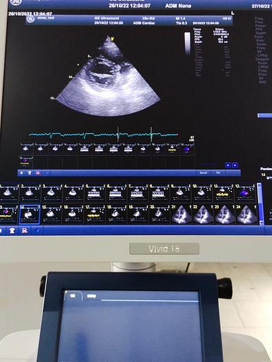 Gebraucht GE Vivid T8 Ultraschallsystem für Herz- und Gefäß-Ultraschall mit Kardio Sonde SW: R1.0.7