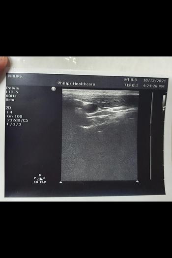 Gebraucht Philips L12-5