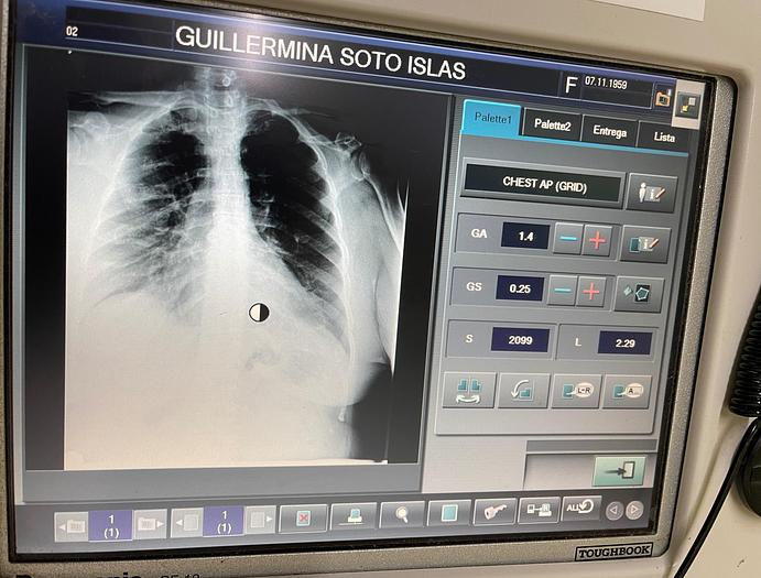 Used 2011 FujiFilm FCR GO-2