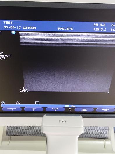 Gebraucht HD 11xe 2197 Ultraschallgerät mit 3 Sonden