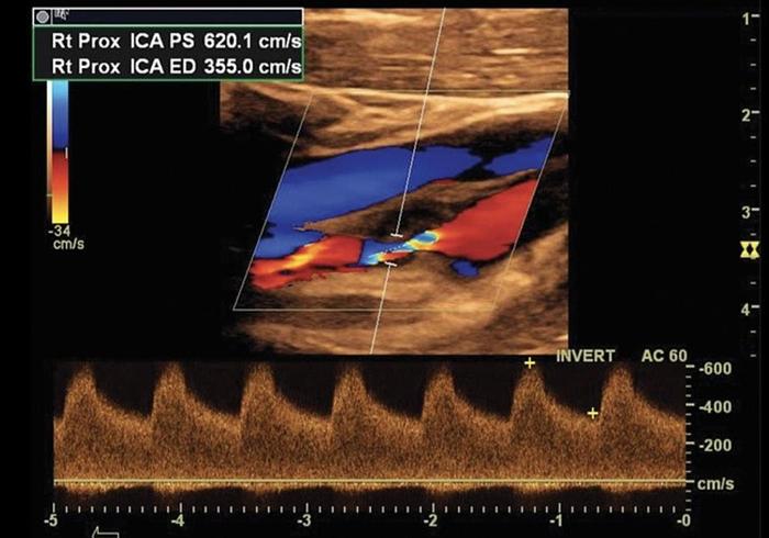 Used 2015 General Electric (GE) Logiq E9