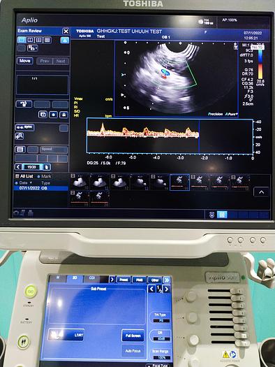 Gebraucht Toshiba Aplio 500 Ultraschallgerät