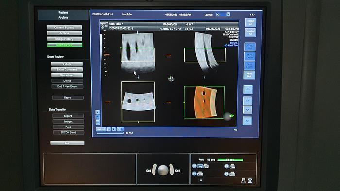 Gebraucht GE Voluson E8