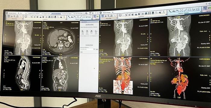 Used GE ADW 4.7 CT Workstation