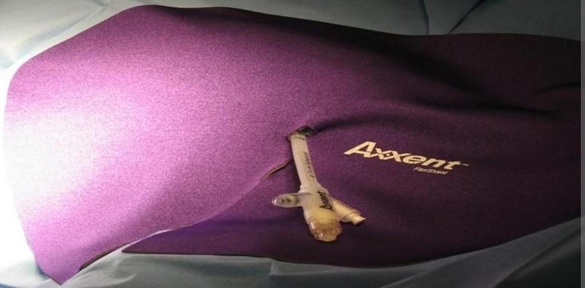 Used Xoft Axxent 110 Controller - IORT Brachytherapy System