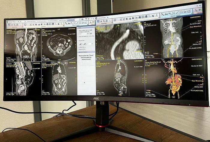 Used GE ADW 4.7 CT Workstation