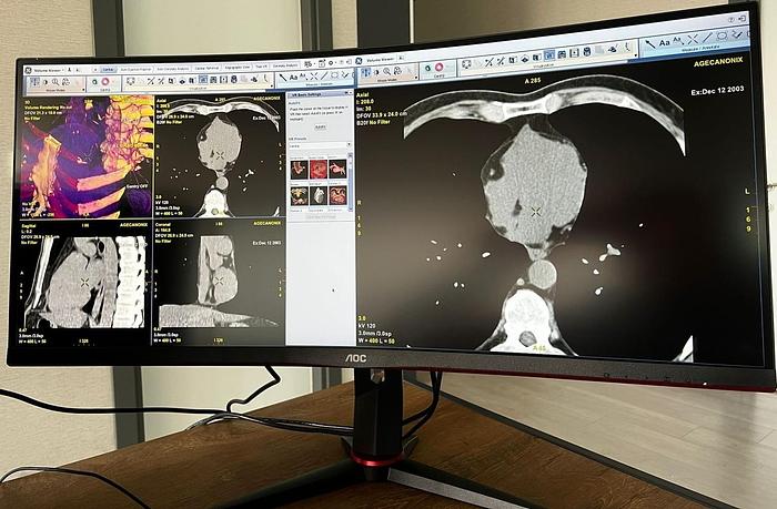 Used GE ADW 4.7 CT Workstation