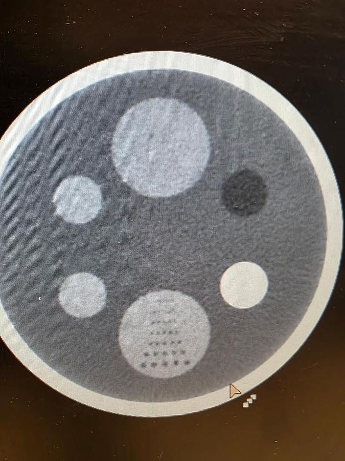 Used Philips INGENUITY 128-slice CT Scanner System