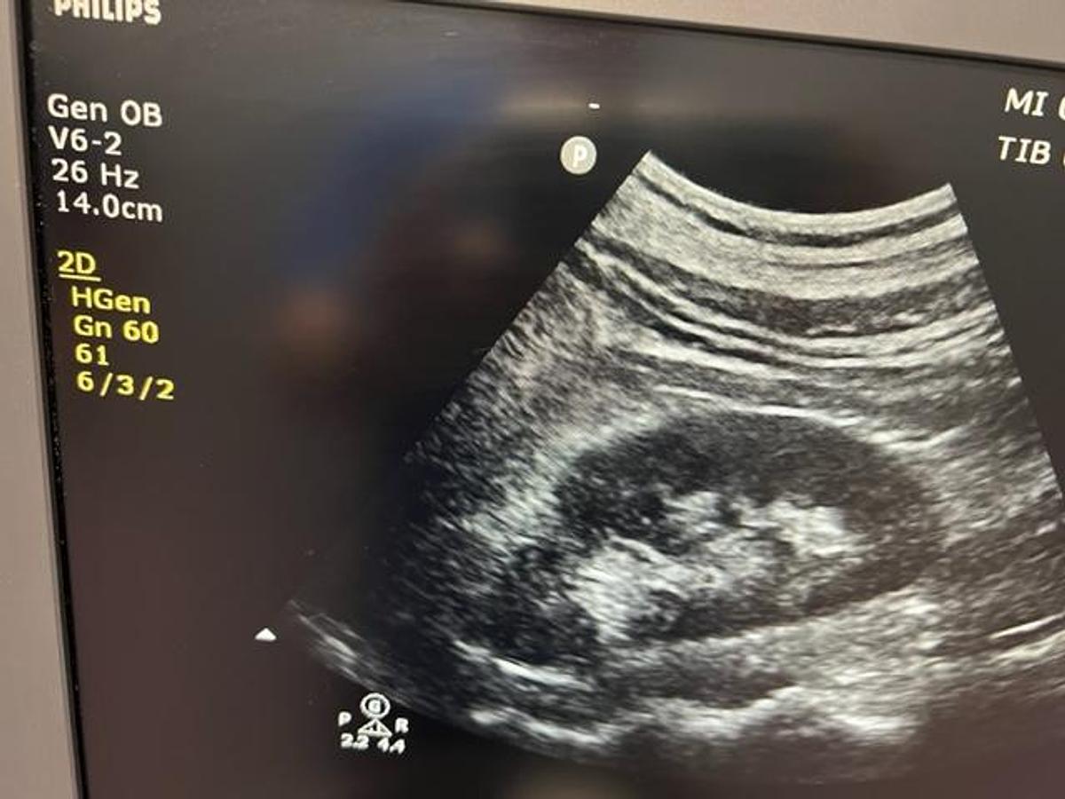 Used 2020 PHILIPS ClearVue 850 Ultrasound System