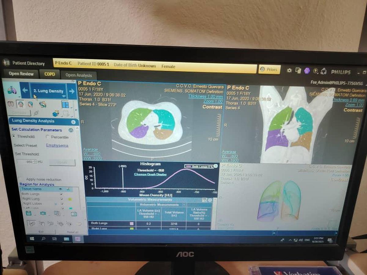 Used Philips IntelliSpace Portal V12