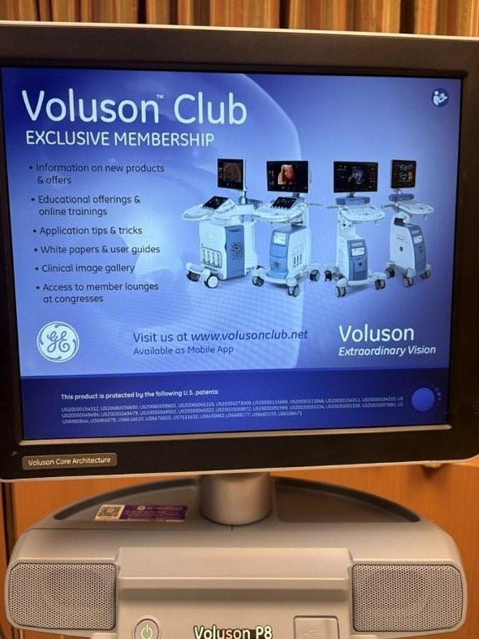 Used VOLUSON P8 BT18 OB/GYN Ultrasound System