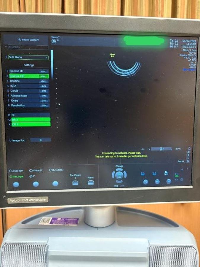 Used VOLUSON P8 BT18 OB/GYN Ultrasound System
