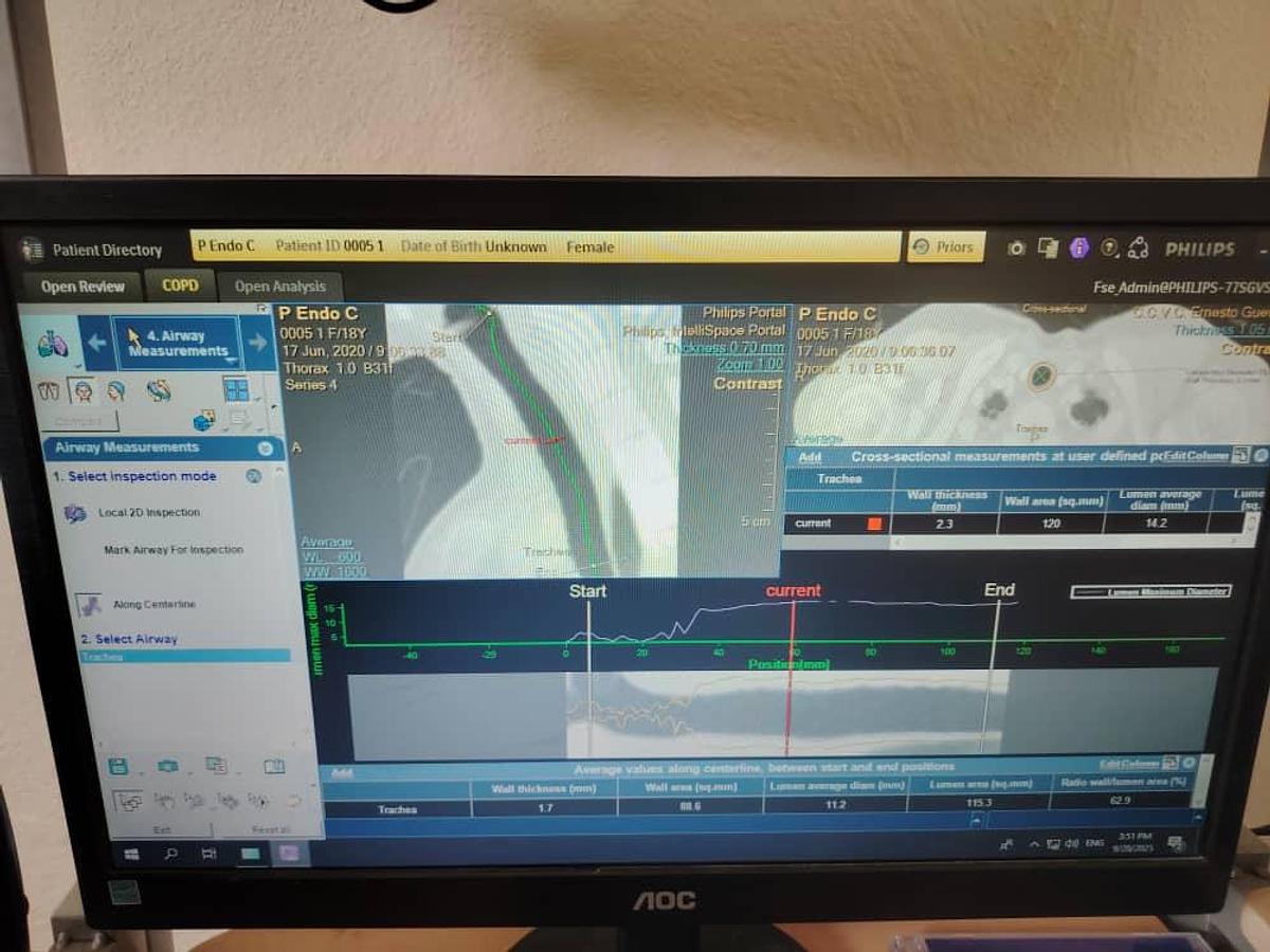 Used Philips IntelliSpace Portal V12 Multi-Modality Workstation