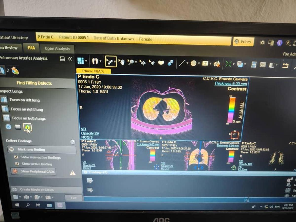 Used Philips IntelliSpace Portal V12