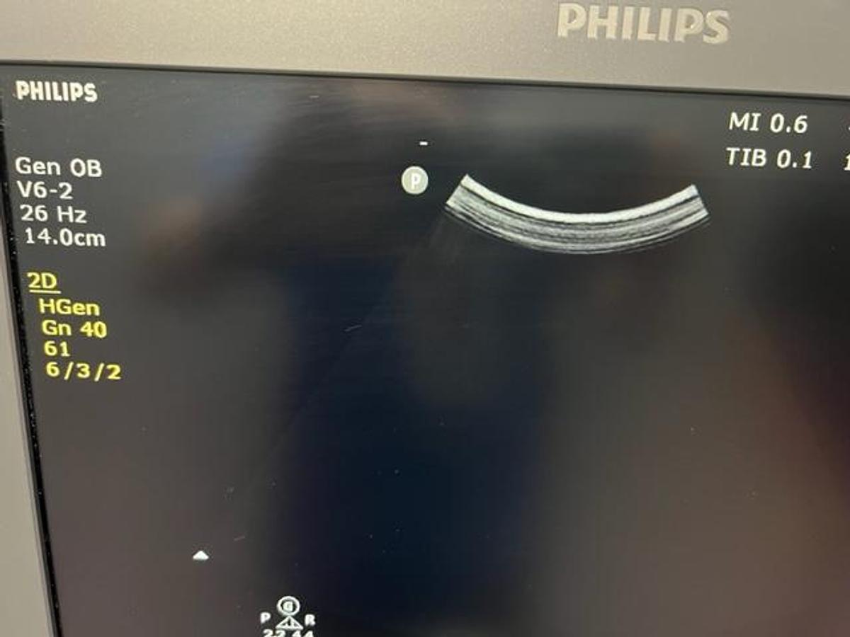 Used 2020 PHILIPS ClearVue 850 Ultrasound System