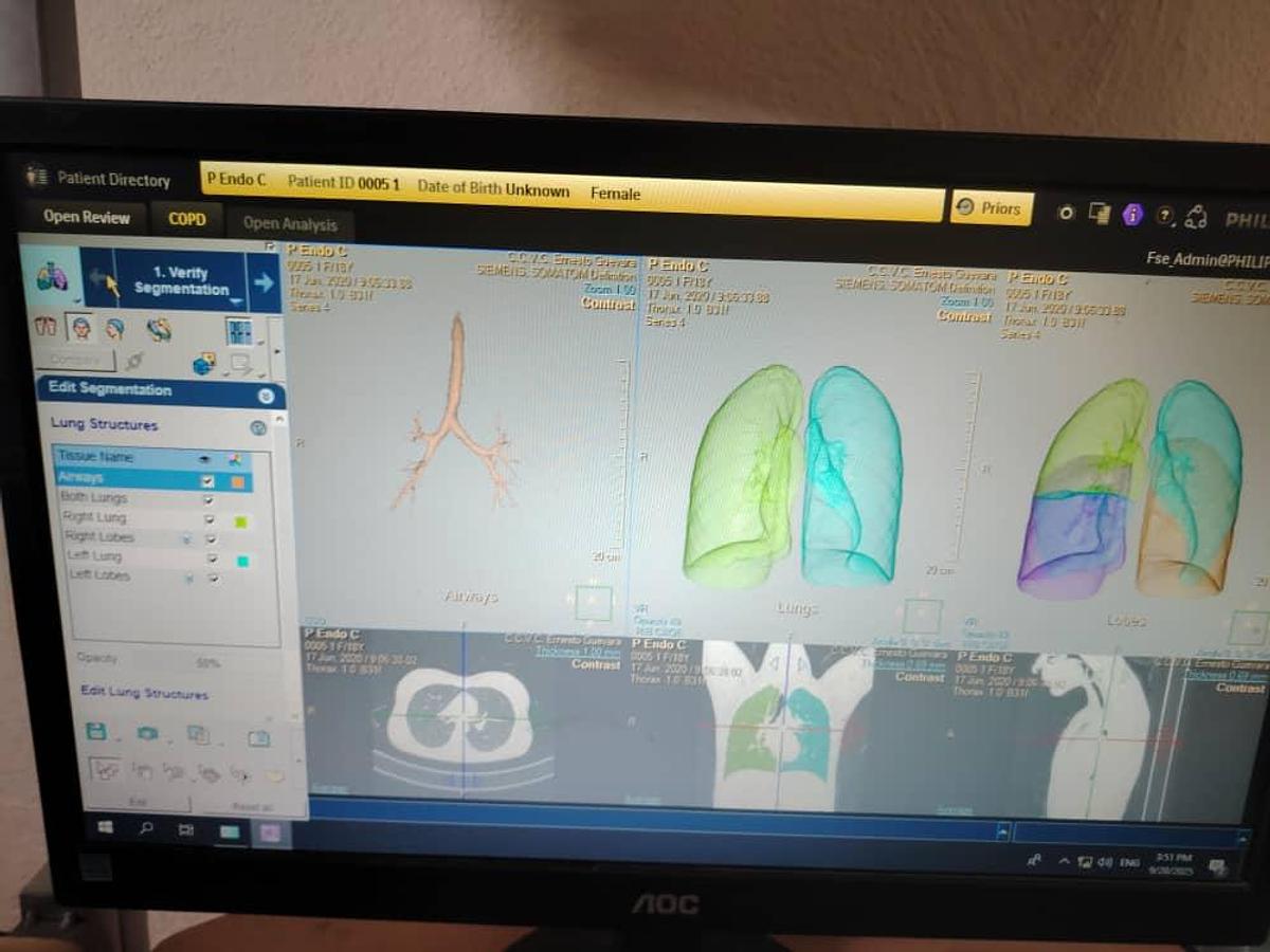 Used Philips IntelliSpace Portal V12