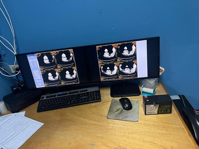 Refurbished GE LightSpeed VCT CT Scanner
