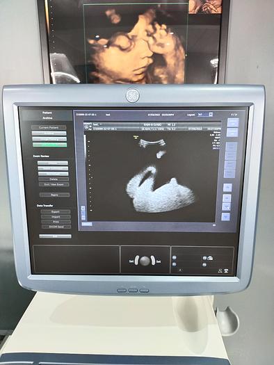 Gebraucht GE Voluson E8 Expert Ultraschallgerät mit RAB4-8-D Sonde und DVD Brenner SW: BT13