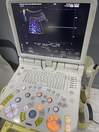 Gebraucht Hitachi/Aloka Noblus Ultraschallgerät auf Cart mit 2 Ultraschallsonden