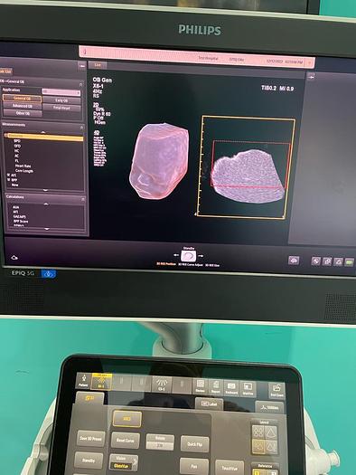 Gebraucht Philips X6-1 xMatrix 3D/4D Volumen Sektor Ultraschallsonde