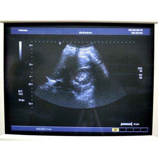 Used TOSHIBA APLIO 80 XARIO AVEC 4 SONDES