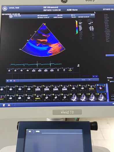 Gebraucht GE Vivid T8 Ultraschallsystem für Herz- und Gefäß-Ultraschall mit Kardio Sonde SW: R1.0.7