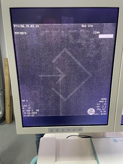Used Ziehm Imaging Vision FD Vario 3D , Mobile C-Arm