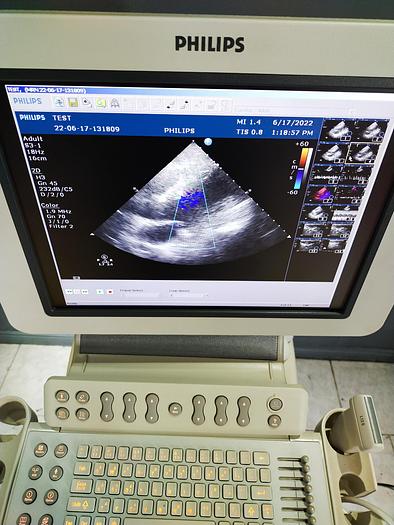 Gebraucht HD 11xe 2197 Ultraschallgerät mit 3 Sonden