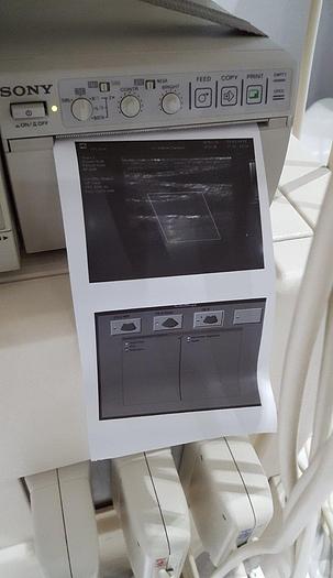 Used Philips ATL HDI 3000 Ultraschallgerät & Farbdoppler mit 4 Sonden, Videocassette Recorder und Drucker