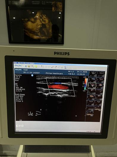 Gebraucht Philips HD 11 XE Ultraschallgerät mit 5x Sonden