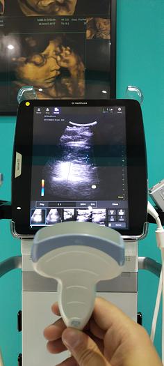 Gebraucht GE Venue 50 Ultraschalgerät mit 2 Sonden