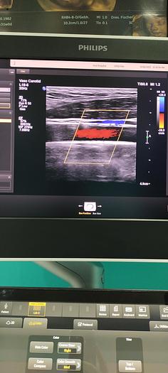 Gebraucht L18-5 Breitband-Linear-Schallkopf