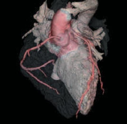 Reformado 2005 General Electric (GE) LightSpeed VCT