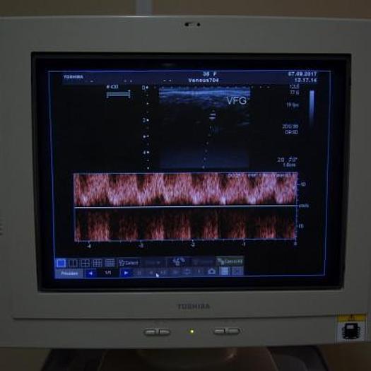 D'occasion ECHOGRAPHE TOSHIBA APLIO COULEUR DOPPLER AVEC 3 SONDES