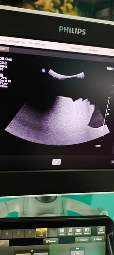 Gebraucht Philips C9-2 PureWave Ultraschallsonde