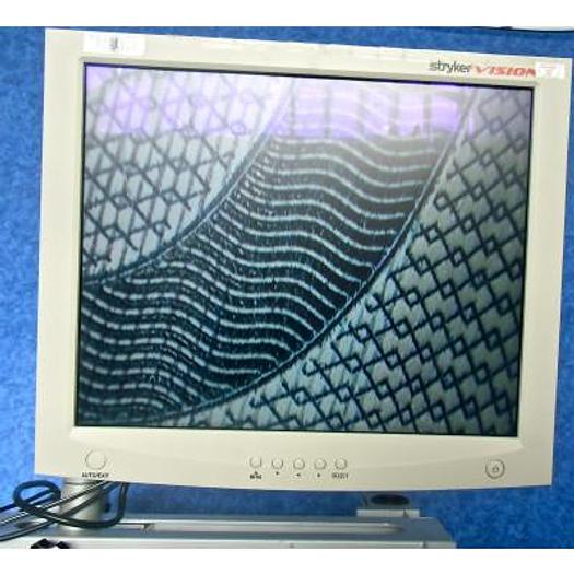 D'occasion COLONNE ENDOSCOPIE STRYKER NUMÉRIQUE HAUTE DEFINITION