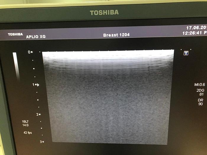 Gebraucht Toshiba PLT-1204BT Lineare Sonde