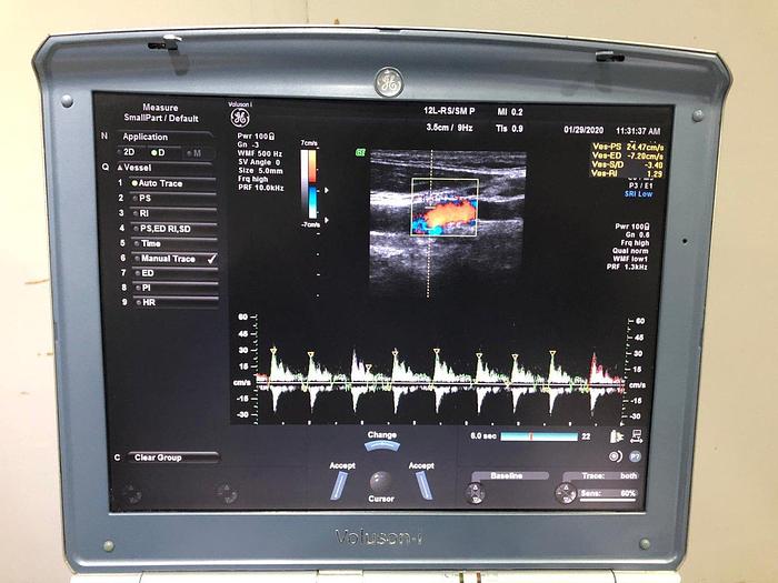 Gebraucht GE Voluson i BT14 tragbares Ultraschallsystem inklusiv Trolley mit 1 Sonde, ROM DVD