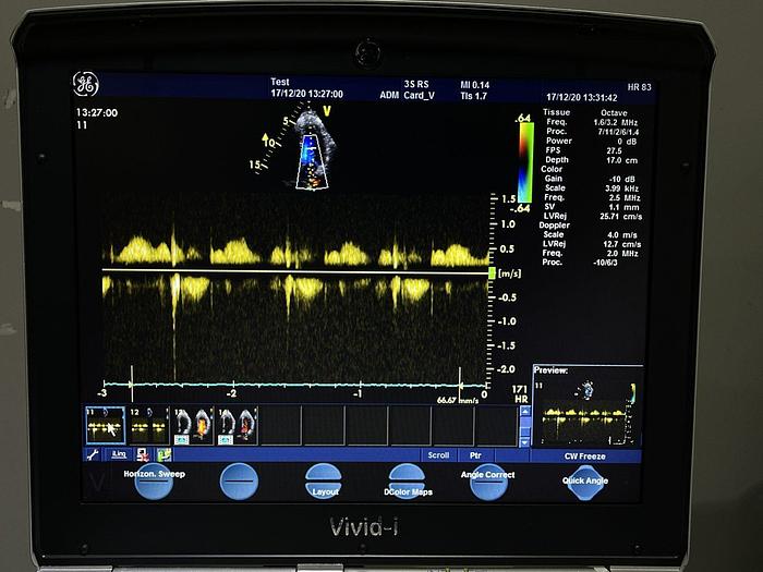 Used GE Vivid i Ultraschallgerät mit 2x Sonden Software Version 2.1.16 auf GE Vivid i Trolley