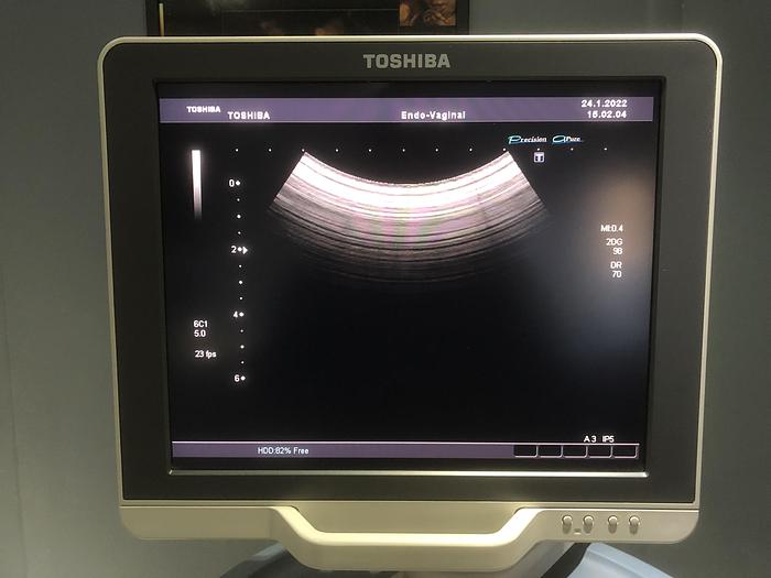Gebraucht TOSHIPA-Xario-Ultraschallgerät-5046